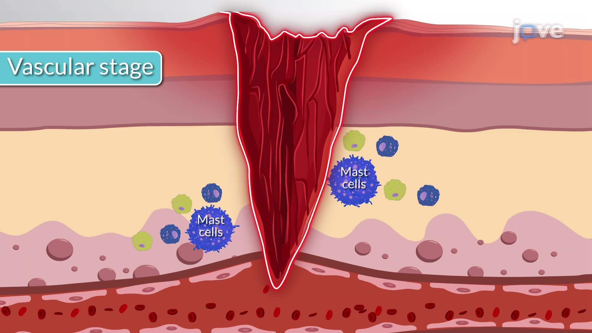 Inflammatory Response I: Vascular and Cellular